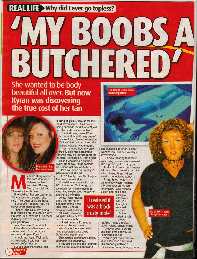 My boobs are butchered