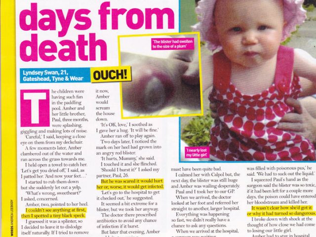 A Blister Nearly Killed My Baby!