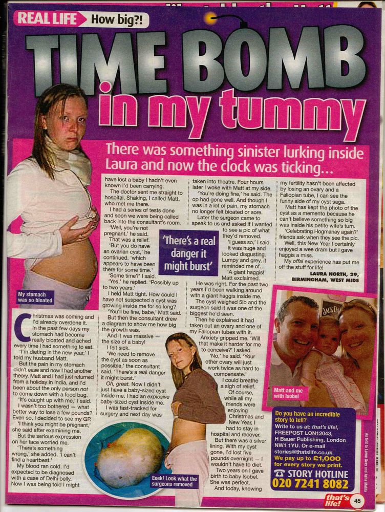 Time bomb in my tummy!
