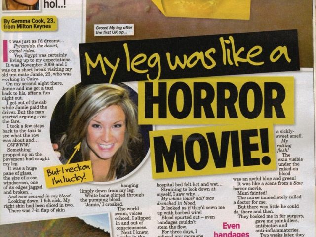 My leg was like a horror movie!