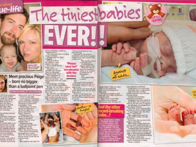The tiniest baby ever!