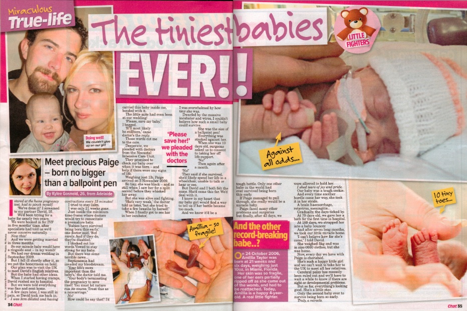The tiniest baby ever!